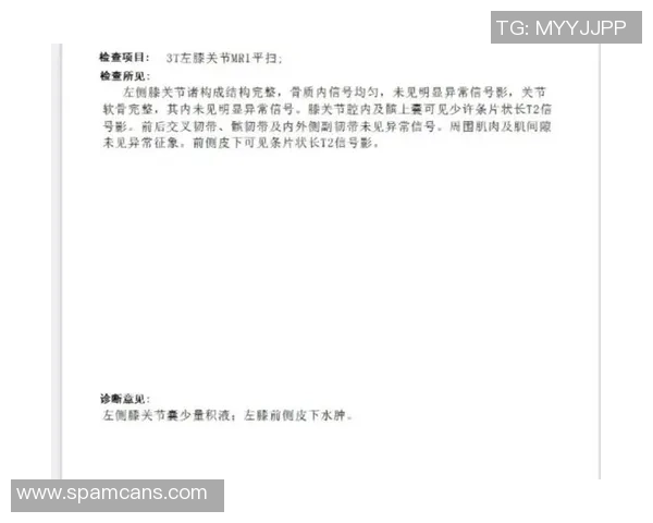 莱奥核磁共振检查结果显示未发现结构性损伤的可能性